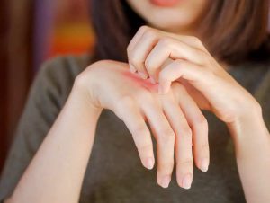 ডেঙ্গু মশা কখন কামড়ায়